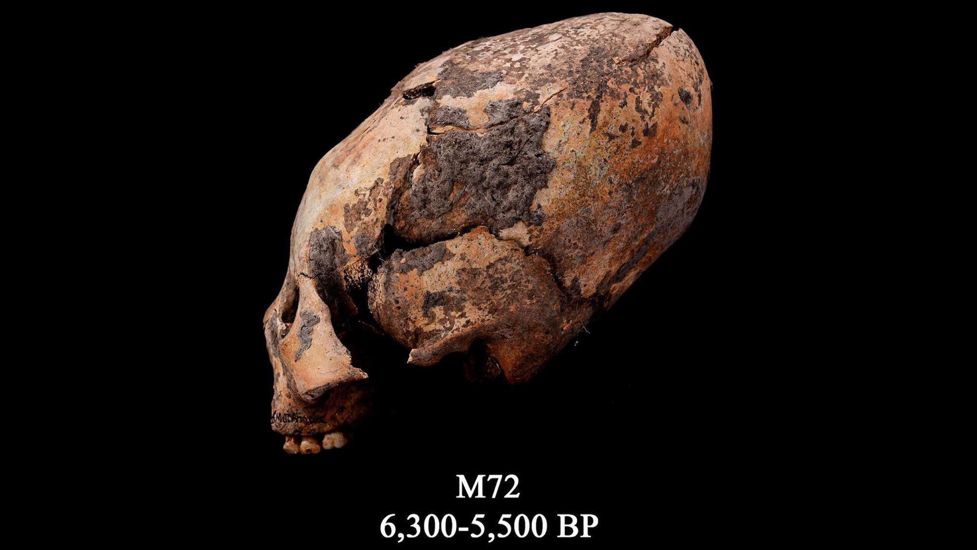 El cráneo conocido como M72.  Este cráneo humano remodelado se encontró en el noreste de China y fue modificado intencionalmente