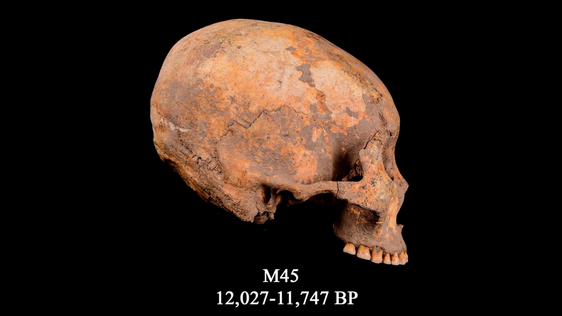 El cráneo conocido como M45, el primer caso conocido de modificación de la cabeza registrado.  Data de hace unos 12.000 años.
